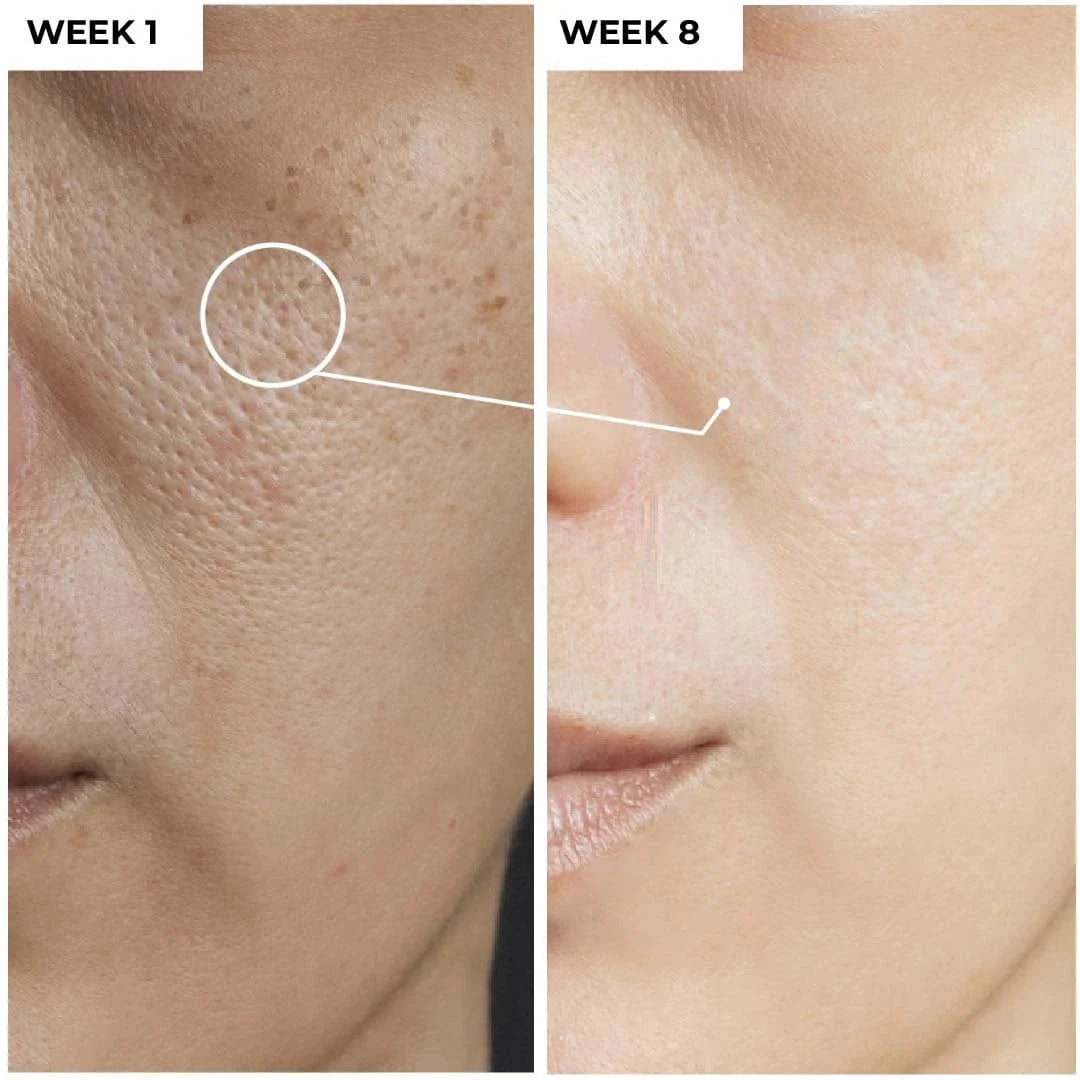 ASMA’S Vitamin C Glow Boost Skincare Set