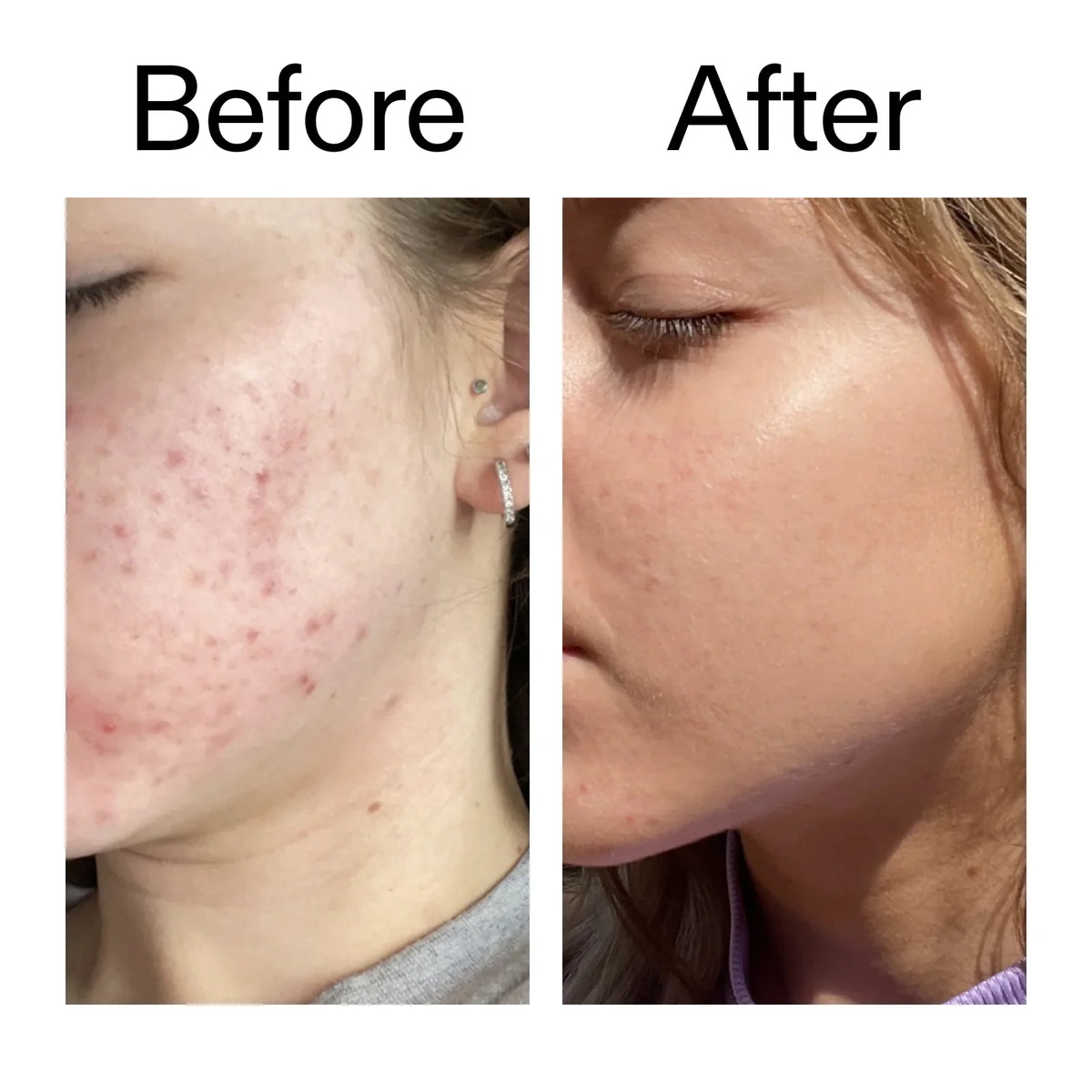 ASMA’S Vitamin C Glow Boost Skincare Set